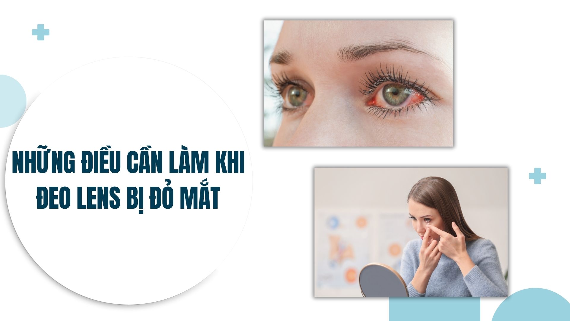 Đeo lens bị đỏ mắt nên làm gì?